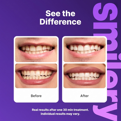 Smilery Whitening Strips